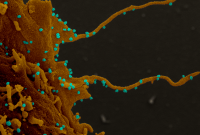 Newsweek: коронавірус змушує клітини відрощувати "щупальця"