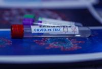 В Донецкой области обнаружили 8 новых случаев заражения COVID-19, всего более 170 больных