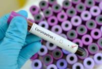 Еще один случай коронавируса обнаружили в Днепропетровской области