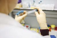 Во Львовской области обнаружили 12 новых подозрений на коронавирус