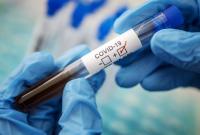 В Херсонской области зафиксировано 215 новых случаев COVID-19